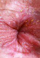 Aubry Babcock Yoga Spreading from ATK Exotics Aubry Babcock from ATK Exotics