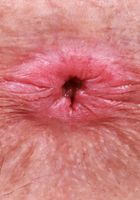 ATK Galleria: Juniper Ren (Juniper Ren Green Dress Stripping and Pussy Spreading)