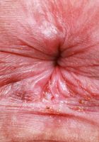 Remi Ferdinand Big Ass Big Bush Spreading, Remi Ferdinand (rem005) ATK Natural & Hairy: Remi Ferdinand (Remi Ferdinand Big Ass Big Bush Spreading)