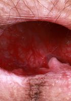 Sia Wood Stockings Big Bush Spreading from ATK Natural & Hairy Sia Wood from ATK Natural & Hairy