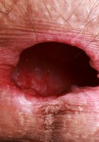 Sia Wood in leather and boots from ATK Natural & Hairy Sia Wood from ATK Natural & Hairy